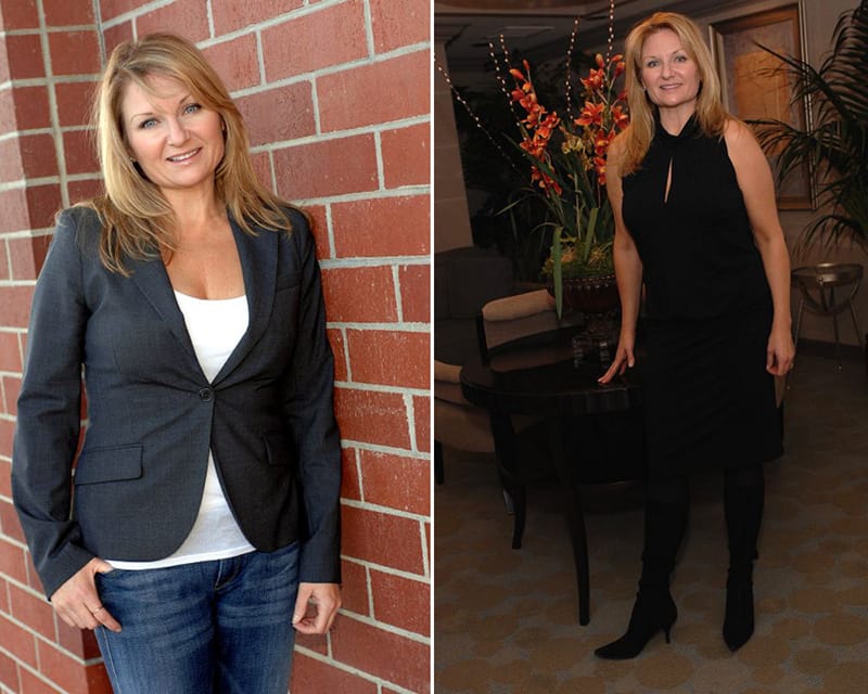 Patient Testimonials: Pamela, Sadrian Plastic Surgery